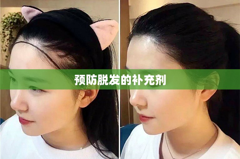 预防脱发的补充剂 预防脱发的补充剂