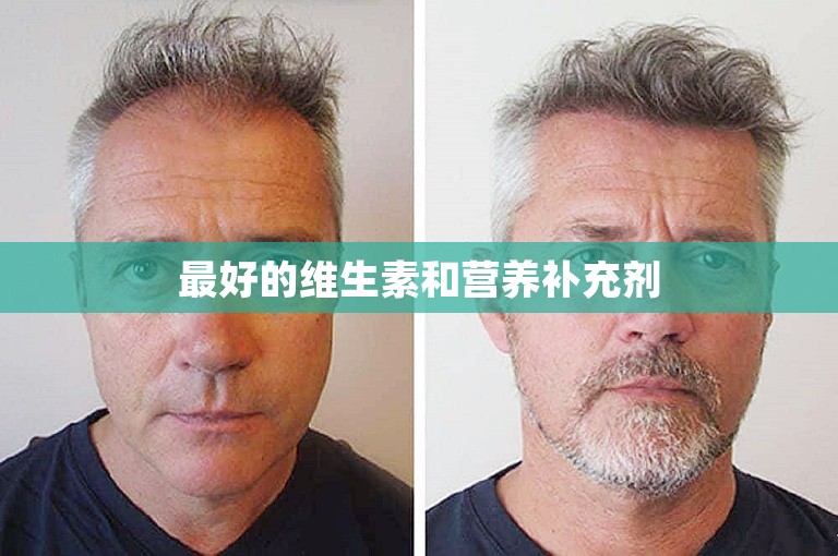 最好的维生素和营养补充剂