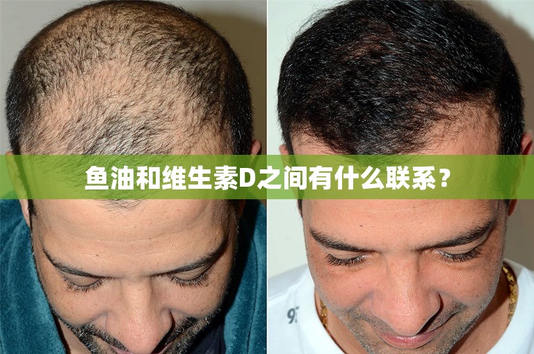 鱼油和维生素D之间有什么联系? 鱼油和维生素D之间有什么联系?