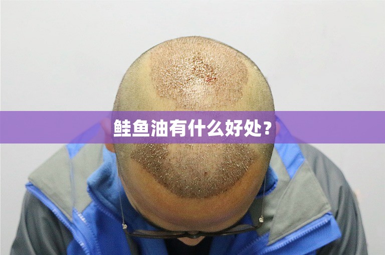 鲑鱼油有什么好处? 鲑鱼油有什么好处?