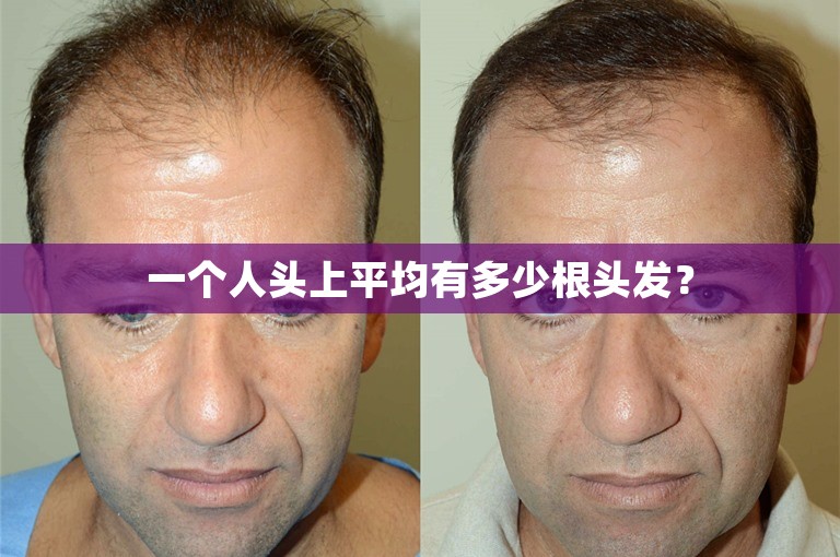 一个人头上平均有多少根头发？