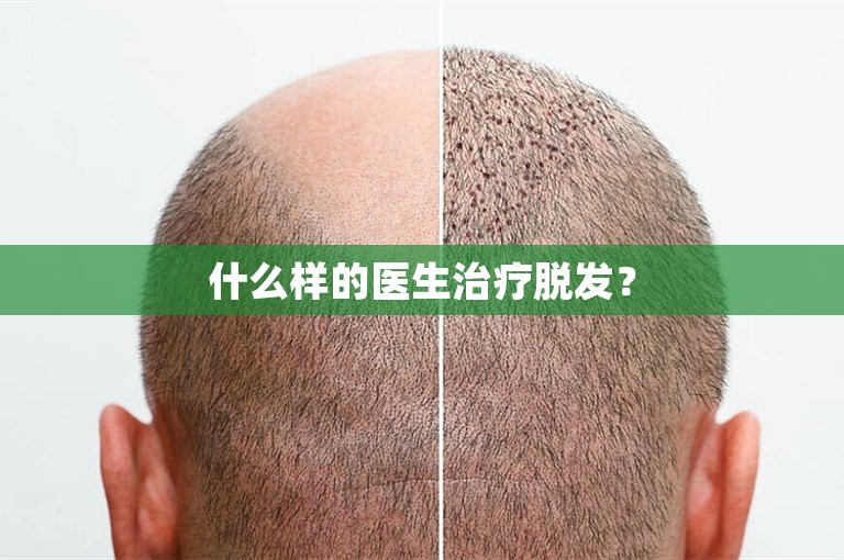 什么样的医生治疗脱发？