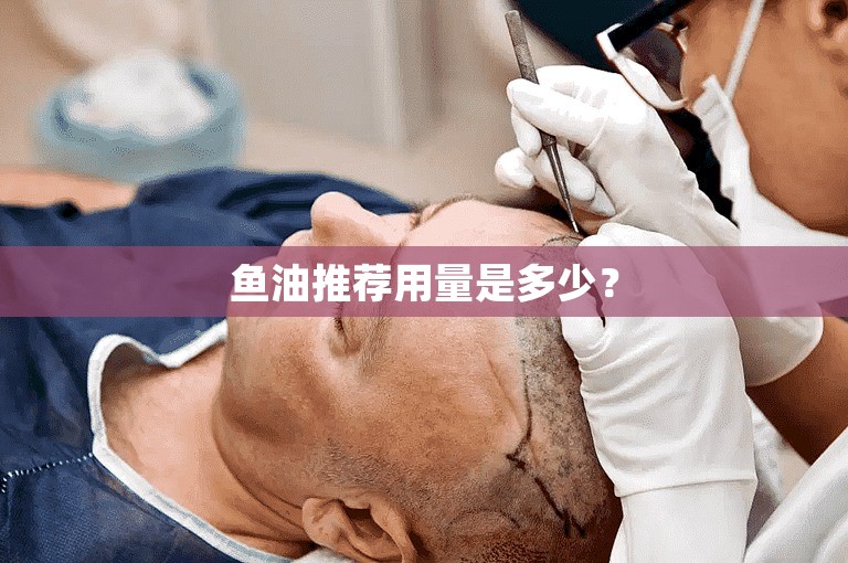 鱼油推荐用量是多少? 鱼油推荐用量是多少?