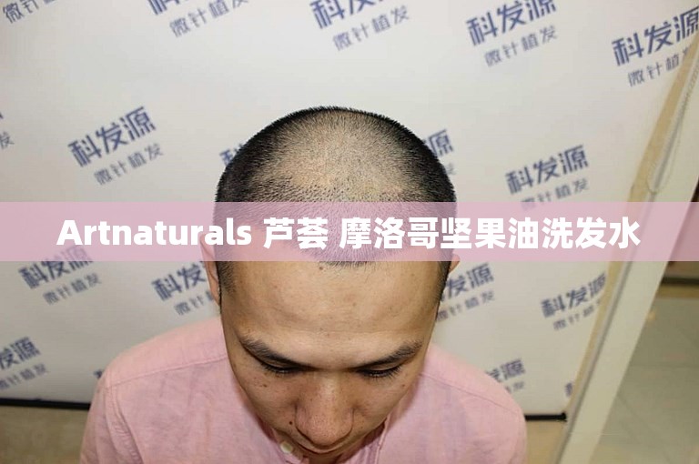 Artnaturals 芦荟 摩洛哥坚果油洗发水