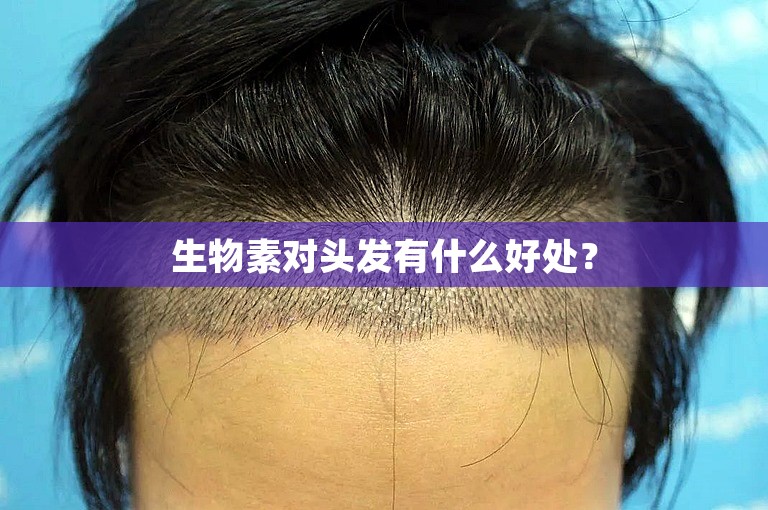 生物素对头发有什么好处？
