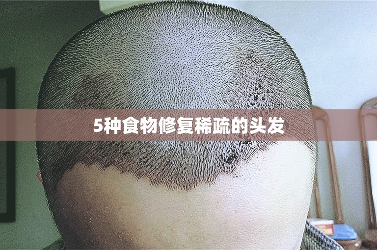 5种食物修复稀疏的头发