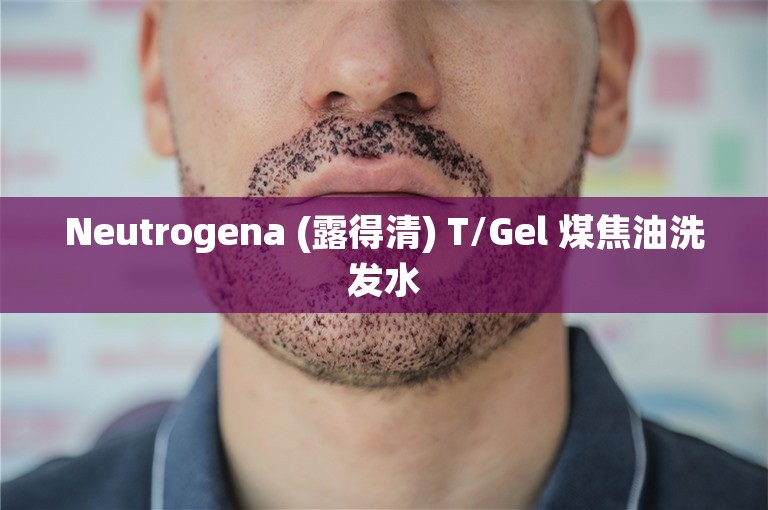Neutrogena (露得清) T/Gel 煤焦油洗发水