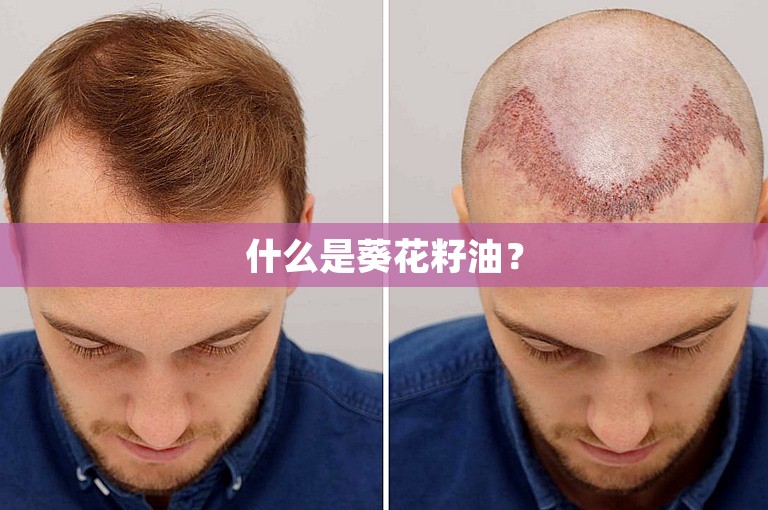 什么是葵花籽油？