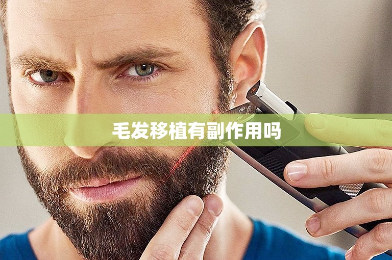 毛发移植有副作用吗