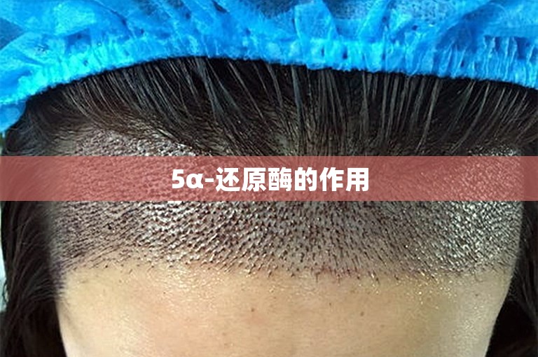5α-还原酶的作用 5α-还原酶的作用