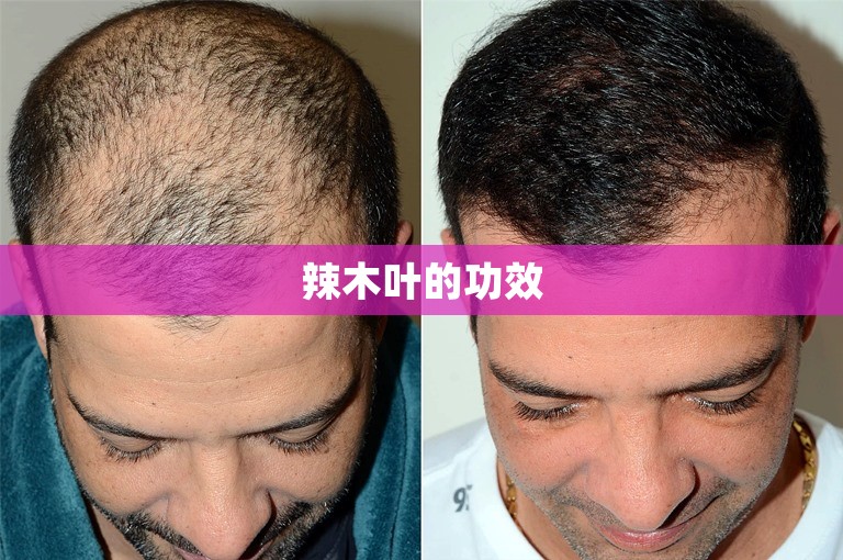 辣木叶的功效