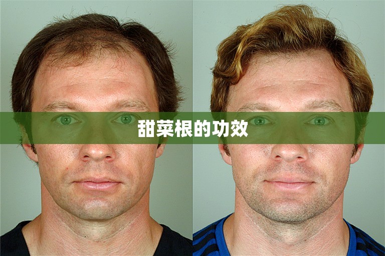 甜菜根的功效