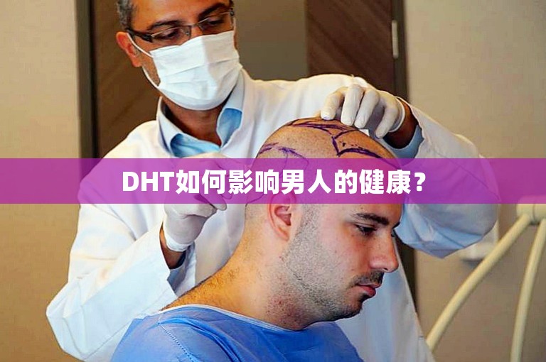 DHT如何影响男人的健康? DHT如何影响男人的健康?