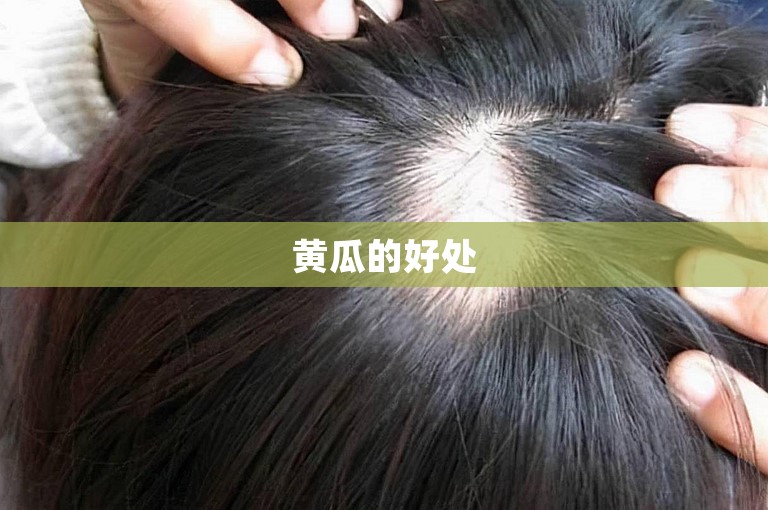 黄瓜的好处 黄瓜的好处
