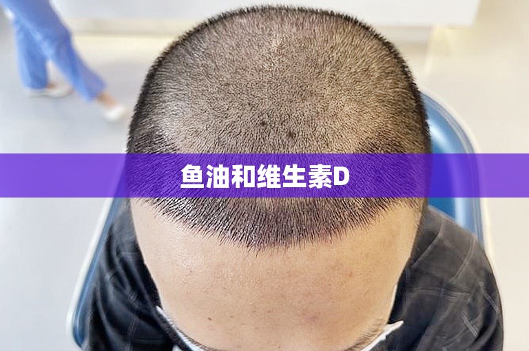 鱼油和维生素D 鱼油和维生素D