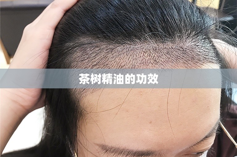 茶树精油的功效