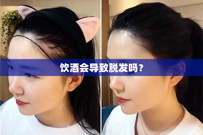 饮酒会导致脱发吗？