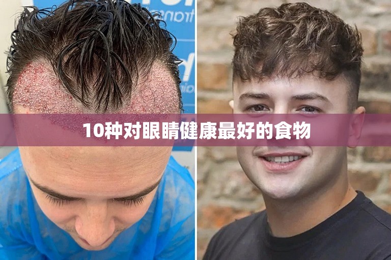10种对眼睛健康最好的食物 10种对眼睛健康最好的食物