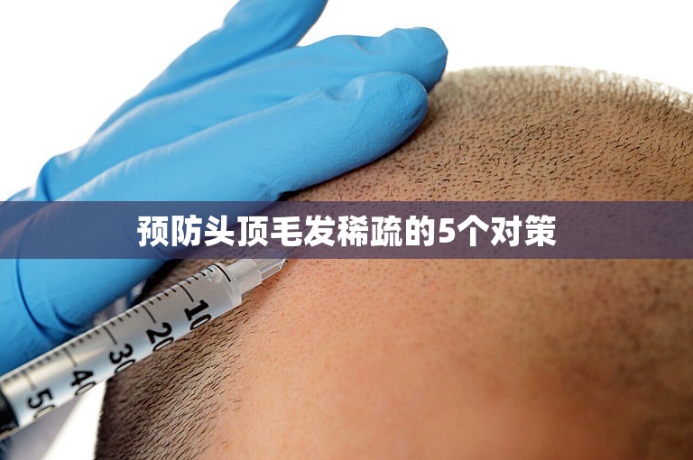 预防头顶毛发稀疏的5个对策 预防头顶毛发稀疏的5个对策