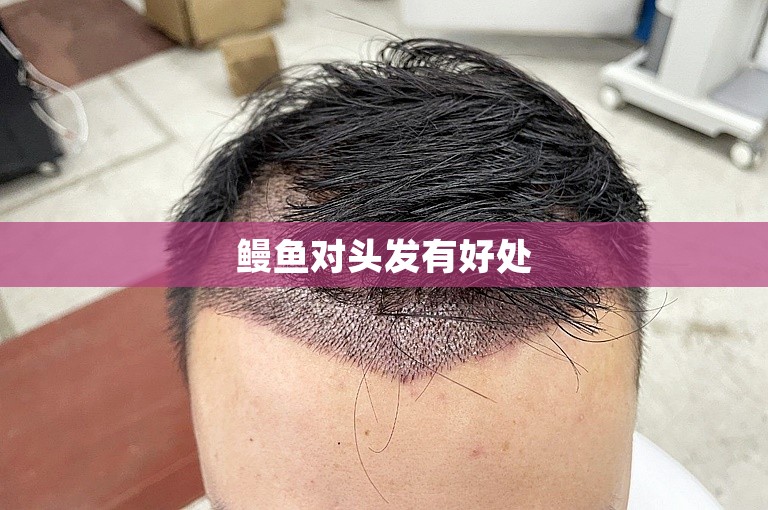 鳗鱼对头发有好处 鳗鱼对头发有好处