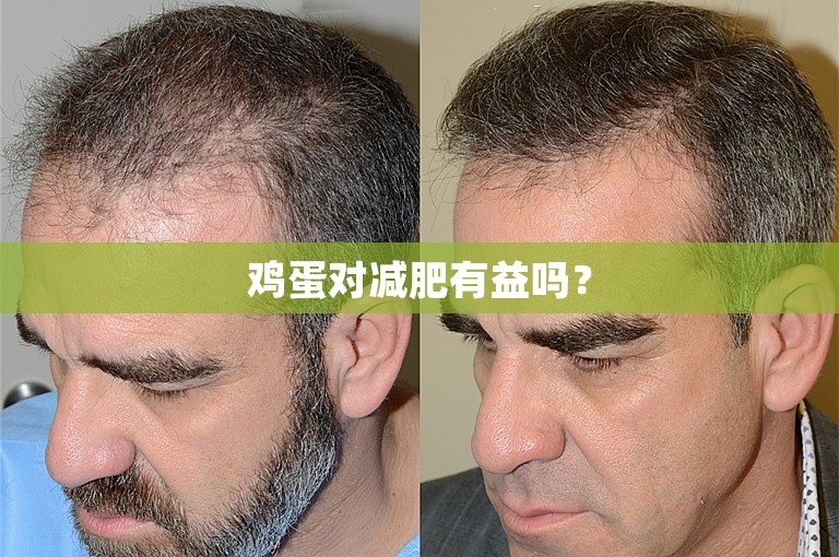 鸡蛋对减肥有益吗? 鸡蛋对减肥有益吗?