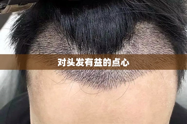 对头发有益的点心