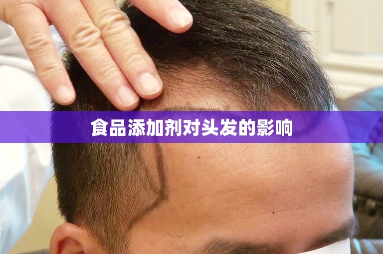 食品添加剂对头发的影响 食品添加剂对头发的影响