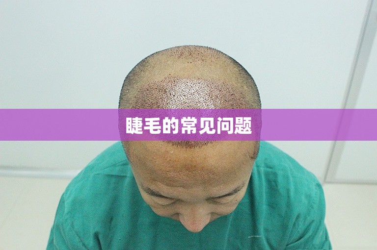 睫毛的常见问题