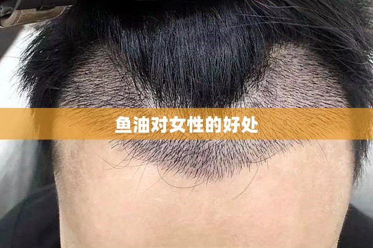 鱼油对女性的好处 鱼油对女性的好处