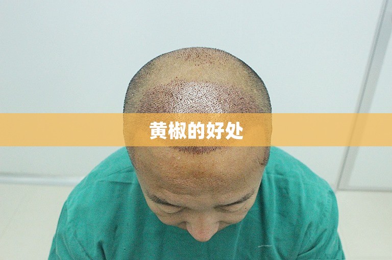 黄椒的好处 黄椒的好处