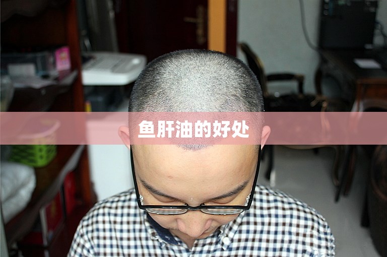 鱼肝油的好处 鱼肝油的好处