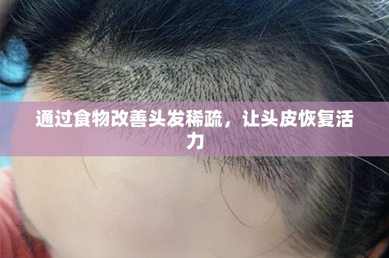 通过食物改善头发稀疏，让头皮恢复活力
