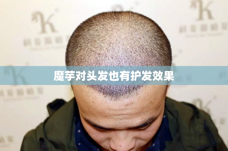 魔芋对头发也有护发效果 魔芋对头发也有护发效果