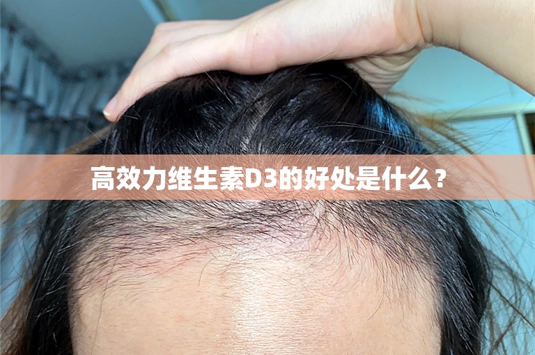 高效力维生素D3的好处是什么? 高效力维生素D3的好处是什么?