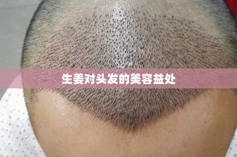 生姜对头发的美容益处