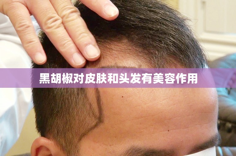 黑胡椒对皮肤和头发有美容作用 黑胡椒对皮肤和头发有美容作用