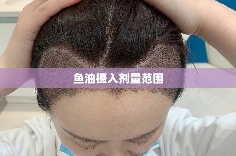 鱼油摄入剂量范围 鱼油摄入剂量范围