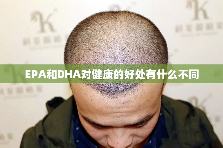 EPA和DHA对健康的好处有什么不同