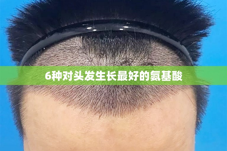6种对头发生长最好的氨基酸 6种对头发生长最好的氨基酸
