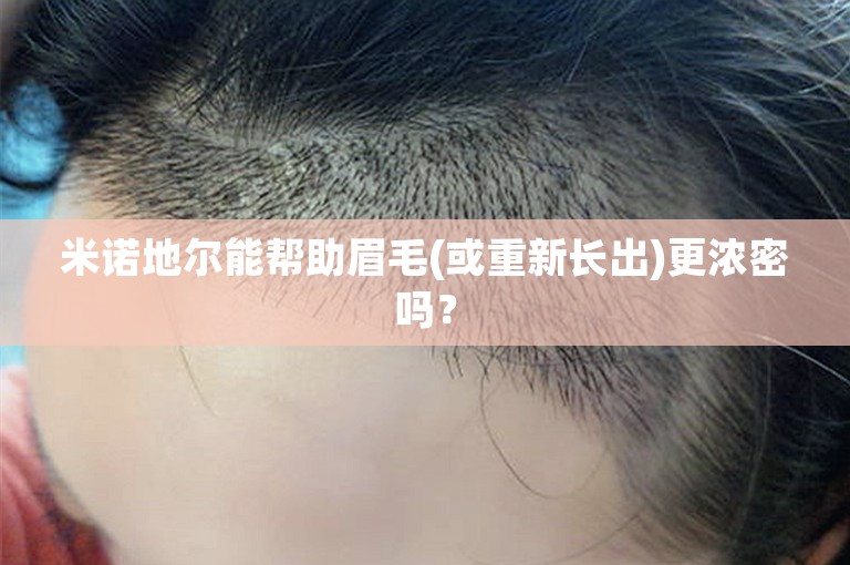 米诺地尔能帮助眉毛(或重新长出)更浓密吗？