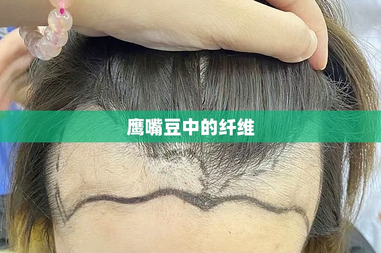 鹰嘴豆中的纤维
