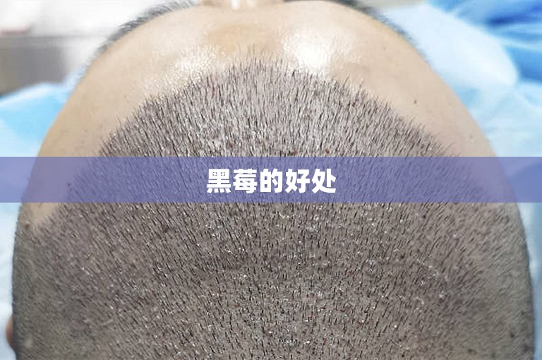 黑莓的好处 黑莓的好处