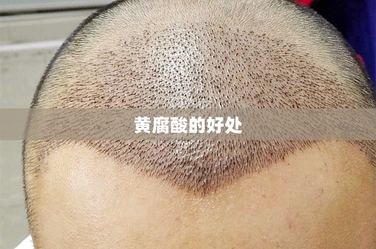 黄腐酸的好处 黄腐酸的好处