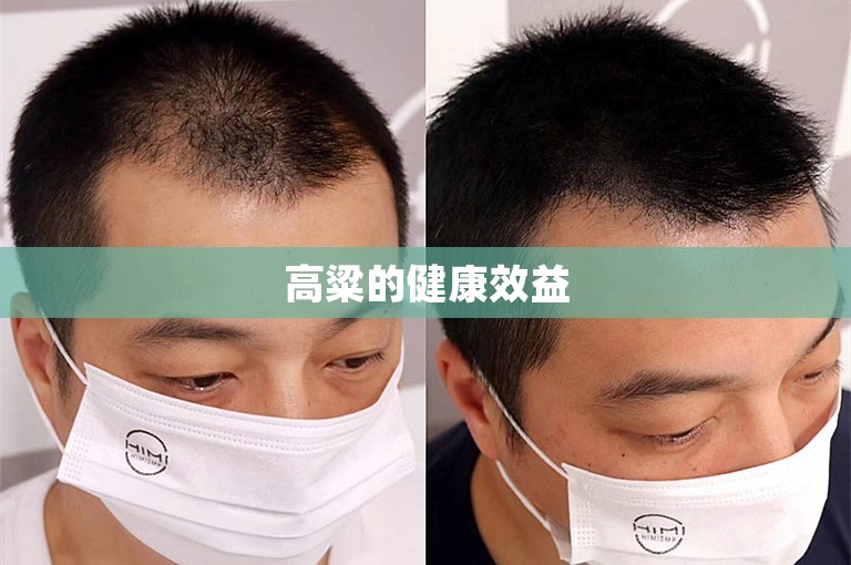 高粱的健康效益 高粱的健康效益