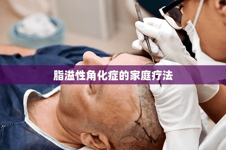 脂溢性角化症的家庭疗法