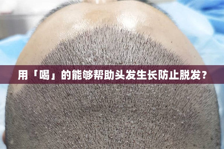用「喝」的能够帮助头发生长防止脱发？