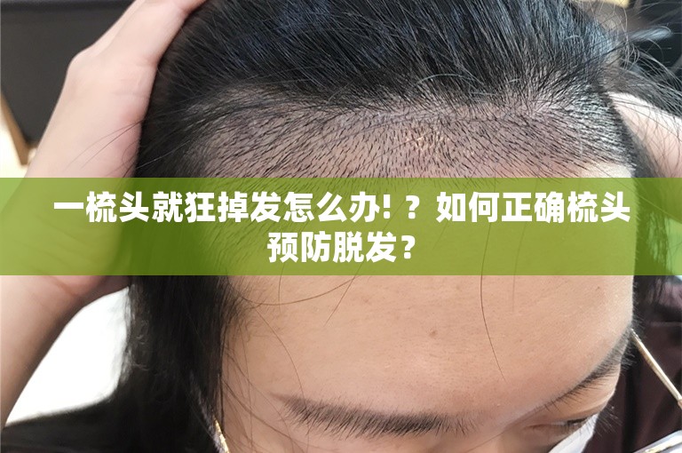 一梳头就狂掉发怎么办! ？如何正确梳头预防脱发？