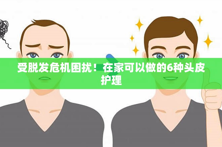 受脱发危机困扰!在家可以做的6种头皮护理 受脱发危机困扰!在家可以做的6种头皮护理