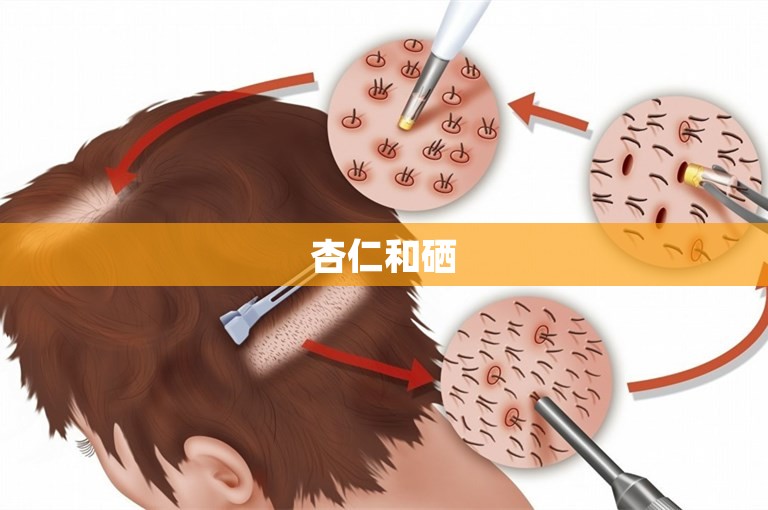 杏仁和硒