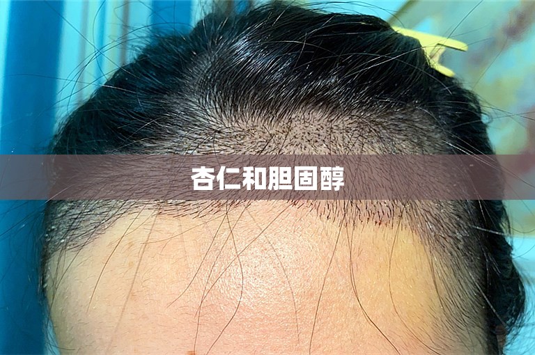 杏仁和胆固醇